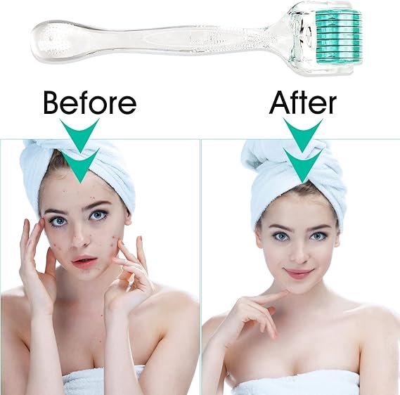 Derma Roller 2.0 Titanium Needles | Microneedling Beard Roller for Growth, Home Use for Skin Care, Face and Body Anti-aging, Wrinkle and Scar Removal, Pore Reduction, Hair Growth for Men Women - Image 6