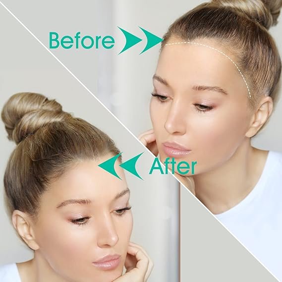 Derma Roller 2.0 Titanium Needles | Microneedling Beard Roller for Growth, Home Use for Skin Care, Face and Body Anti-aging, Wrinkle and Scar Removal, Pore Reduction, Hair Growth for Men Women - Image 7