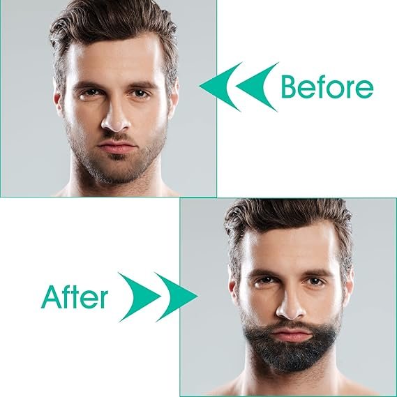 Derma Roller 2.0 Titanium Needles | Microneedling Beard Roller for Growth, Home Use for Skin Care, Face and Body Anti-aging, Wrinkle and Scar Removal, Pore Reduction, Hair Growth for Men Women - Image 8