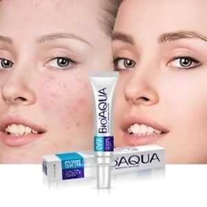 BioAqua acne cream | Bio Aqua Removal of Acne