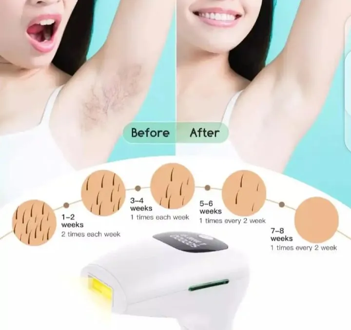 Laser Permanent Hair Removal Device Epilator Face Body . - Image 4