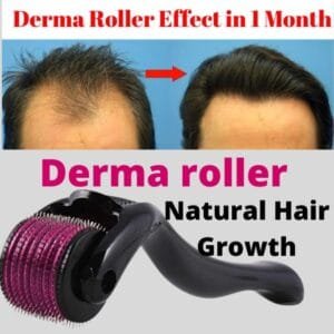 Derma Roller Hair Therapy Micro-Needle | Derma Roller for Hair re-growth & Skin For Male And Female (0.5mm)