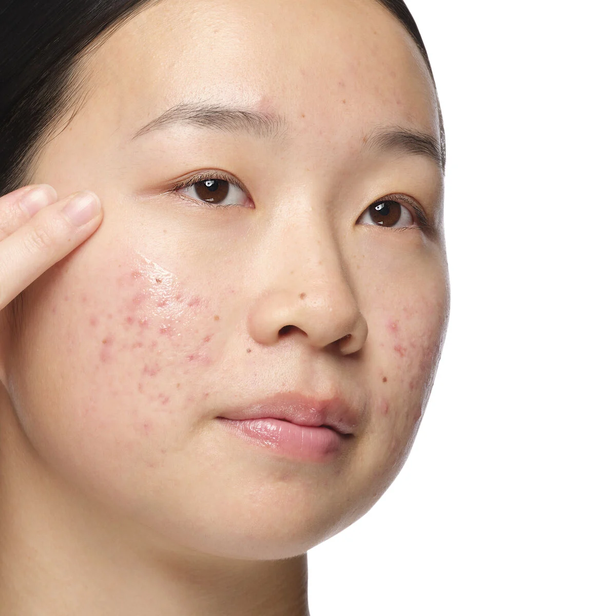 The Ordinary. Aloe 2% + NAG 2% Solution - Image 5